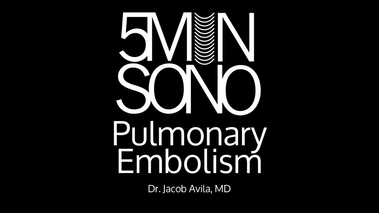Image of Pulmonary Embolism (Pulmonary Findings)