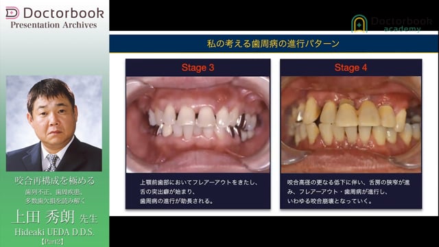 咬合再構成を極める -歯列不正、歯周疾患、多数歯欠損を読み解く