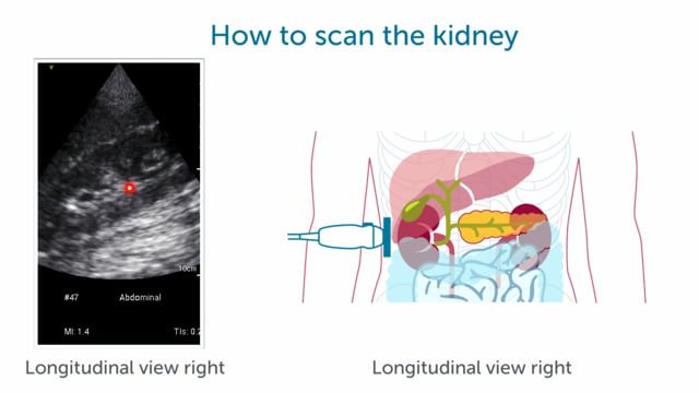 How should I scan the kidneys?