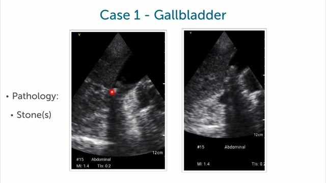 Cases: diseases of the bile system