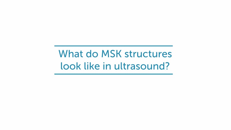 What do MSK structures look like in ultrasound?