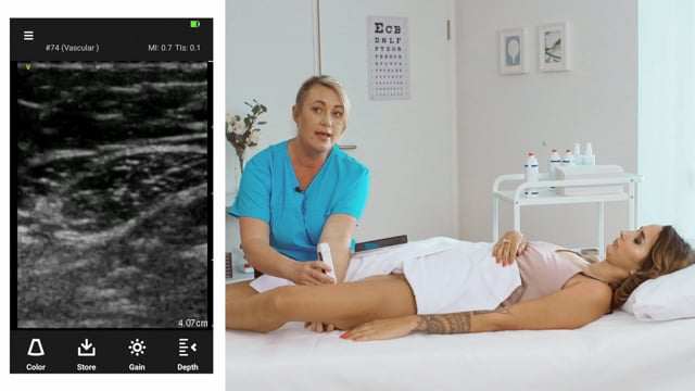 How can I scan the thigh veins in a patient?