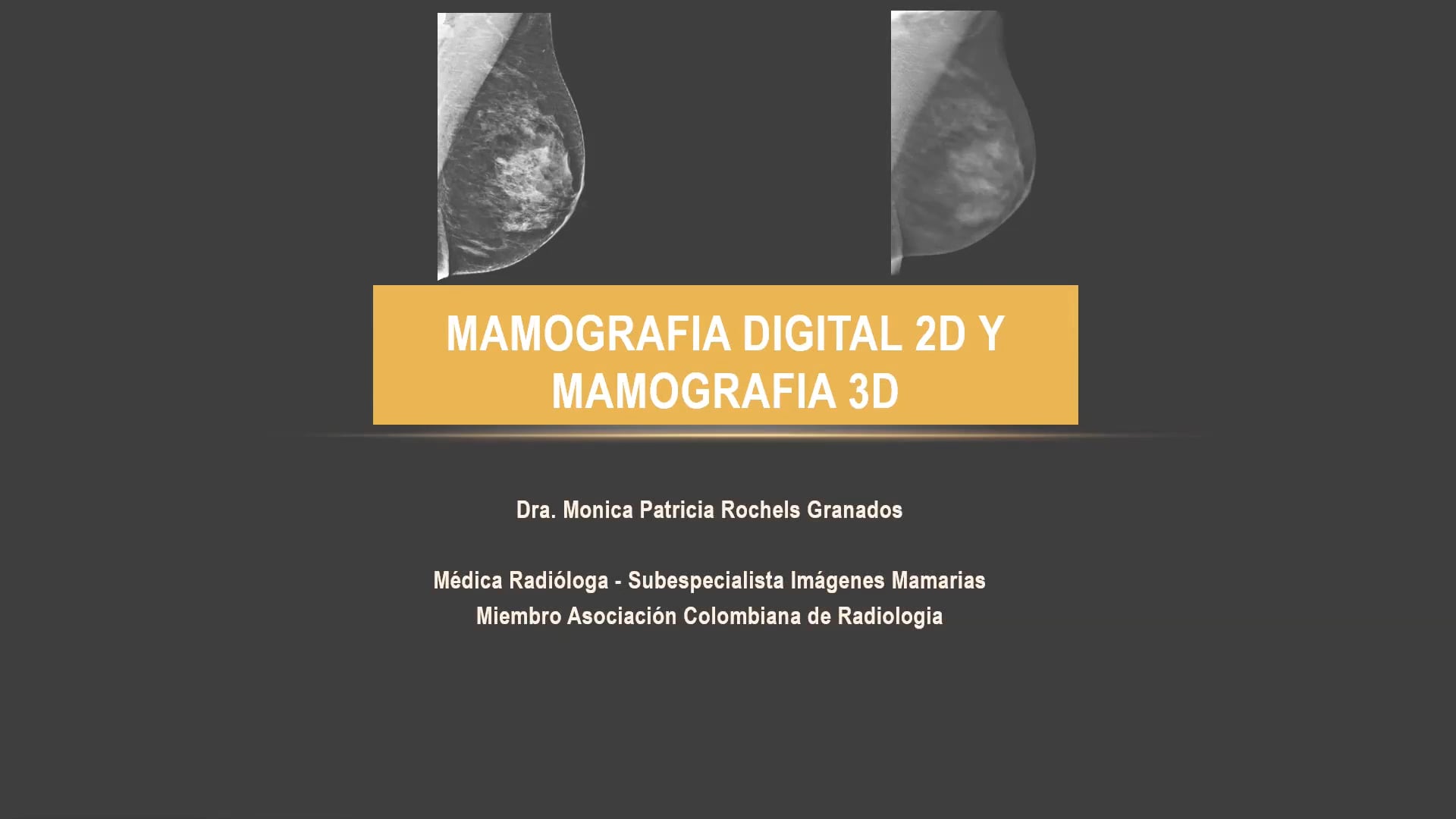 Mamografía 2D y 3D