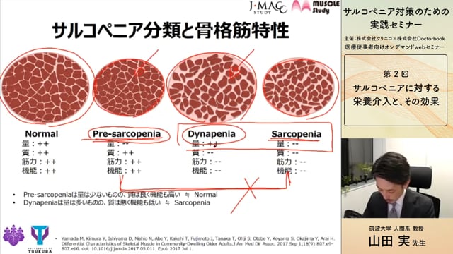 山田 実 先生：第2回 サルコペニア対策のための実践セミナー