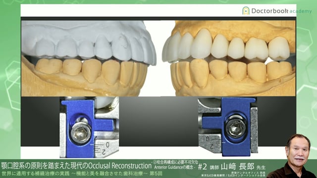 #6 咬合再構成に必要不可欠なAnterior Guidanceの概念