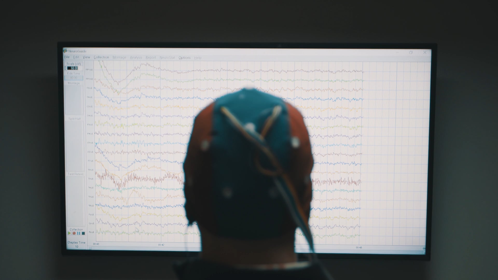 Brand Story | Neurocore