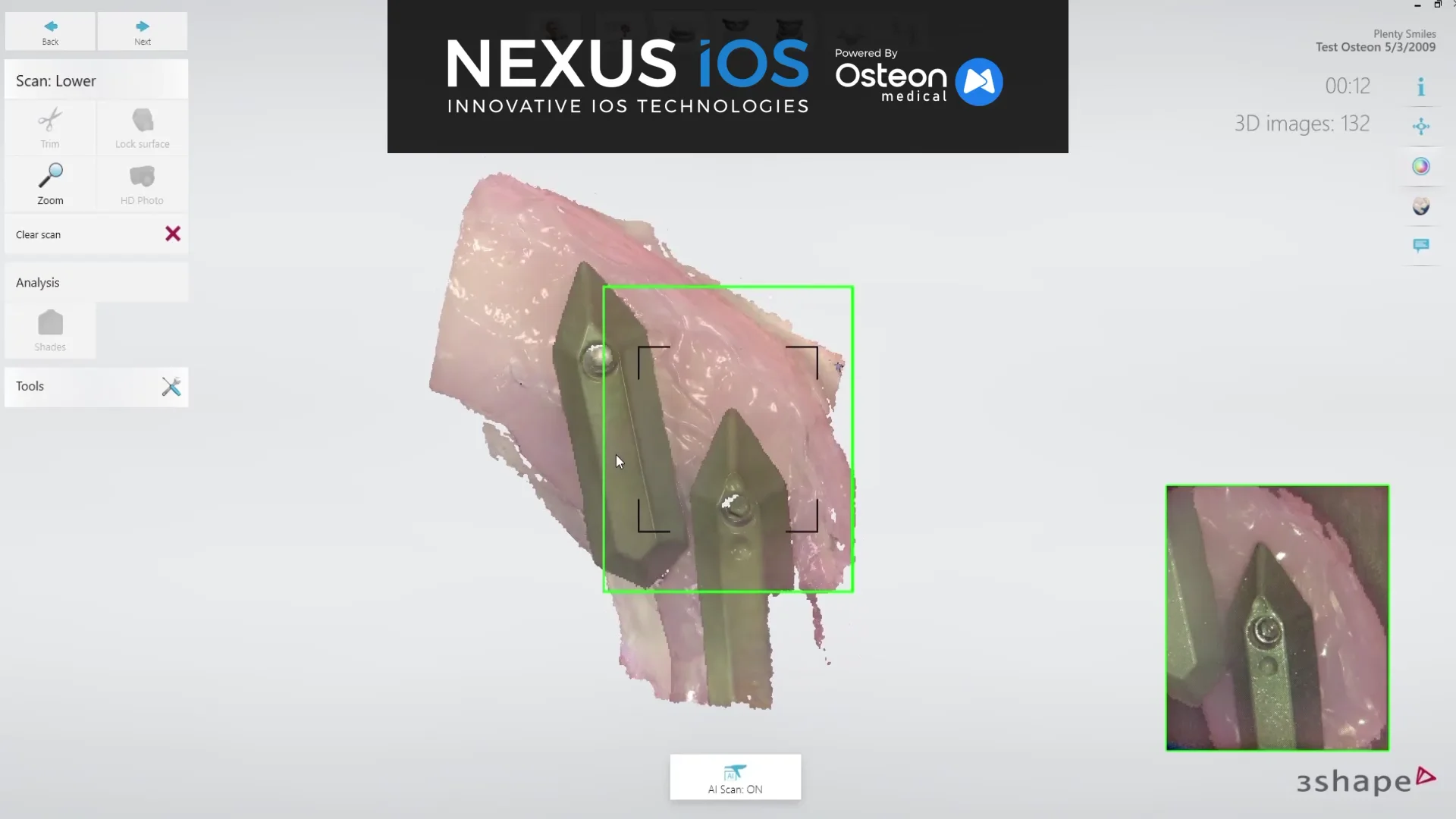Scanning — Nexus iOS