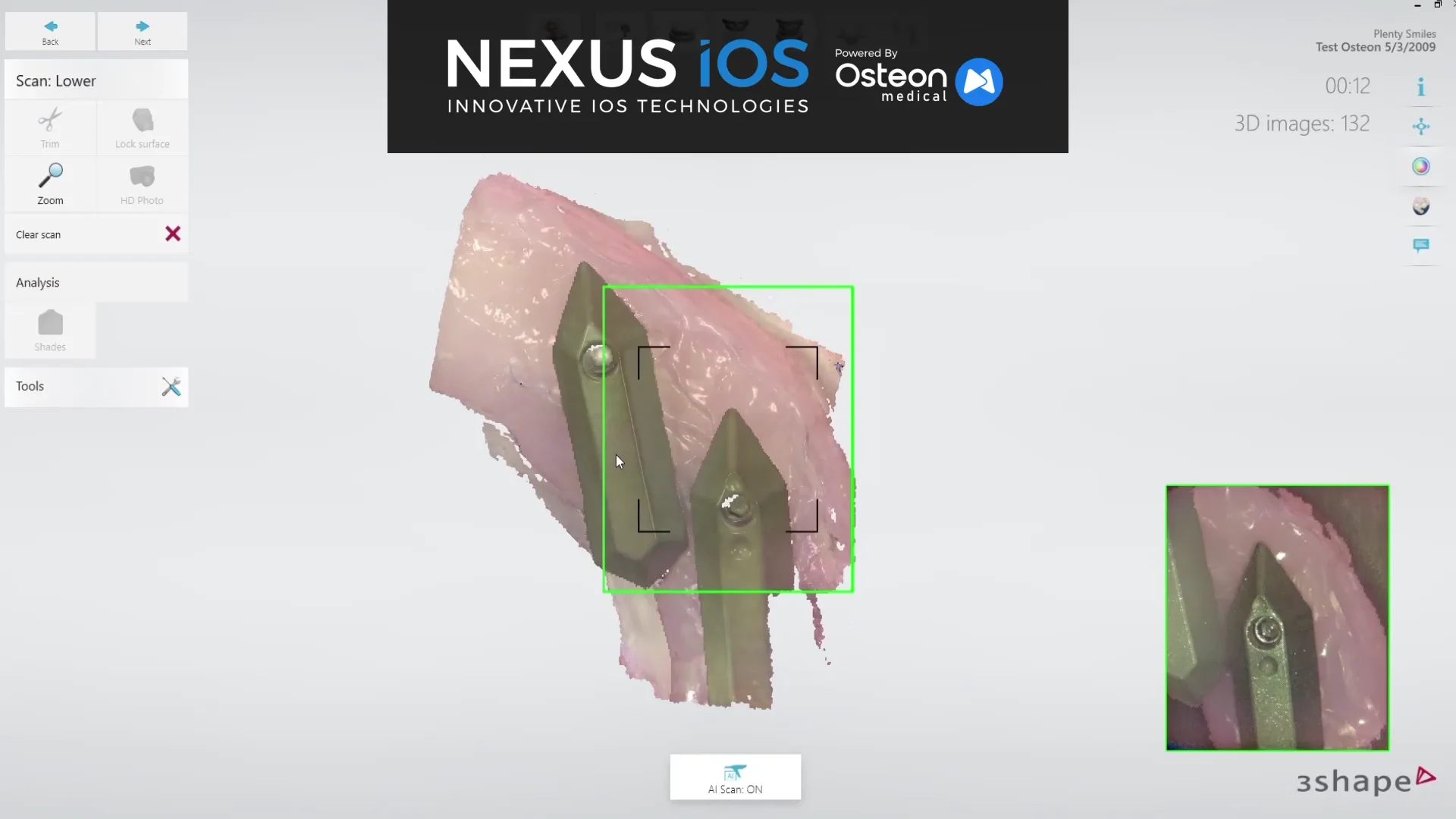 About Nexus iOS Scanning System — Nexus iOS