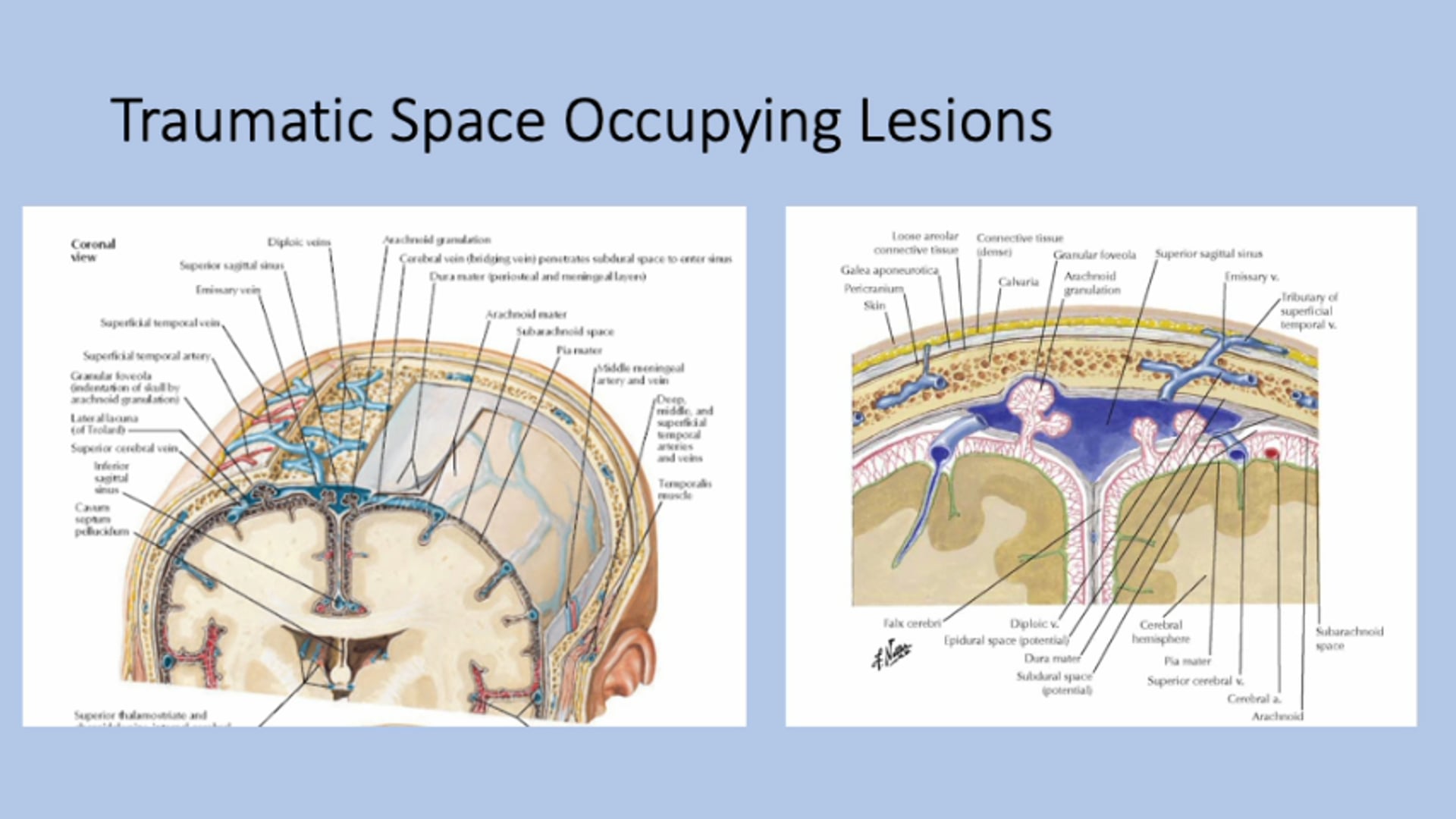 Critical Care Management of Traumatic Brain Injuries and Intracranial Hypertension