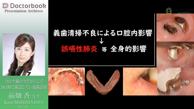 コロナ禍の今だからこそ Dr.DHで確認したい義歯清掃