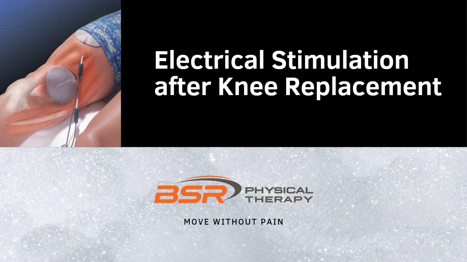 How Electrical Stimulation Is Used in Physical Therapy