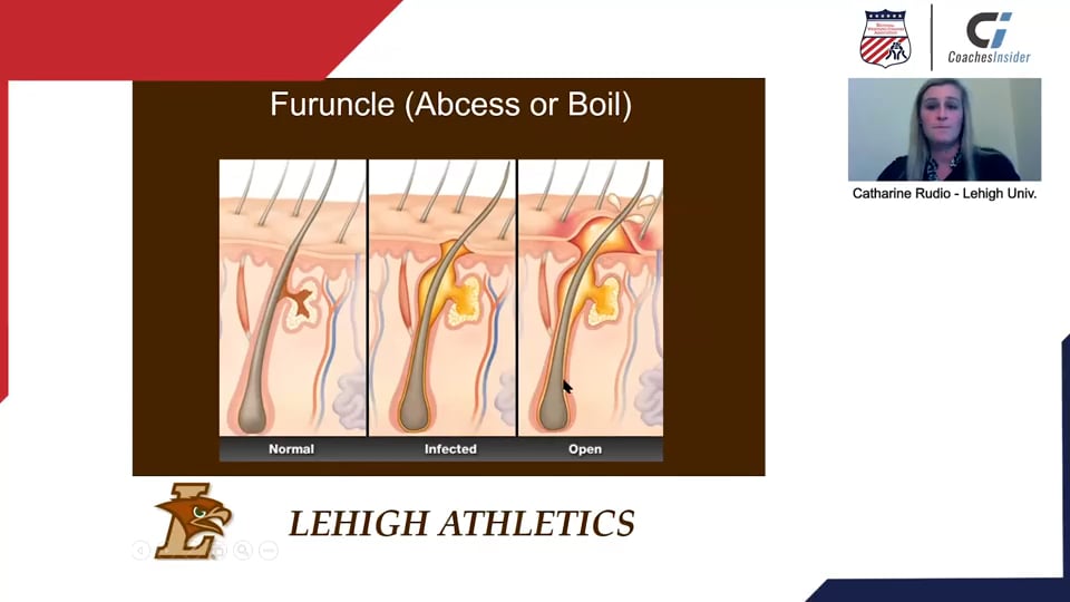 Skin Infection Awareness and Best Practices.mp4