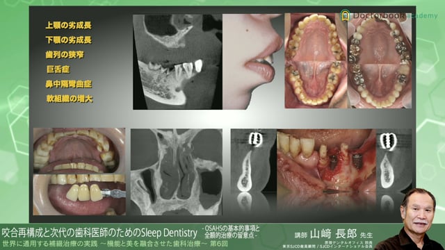 #7 咬合再構成と次代の歯科医師のためのSleep Dentistry -OSAHSの基本的事項と全額的治療の留意点-