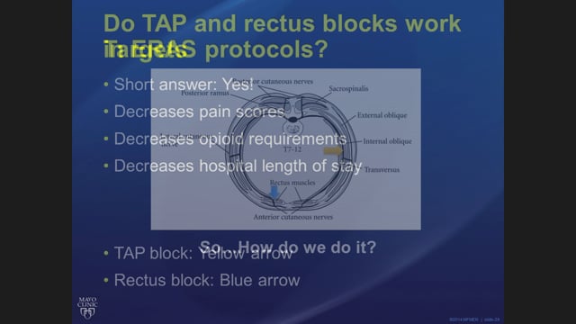 US Guided TAP and Rectus Blocks