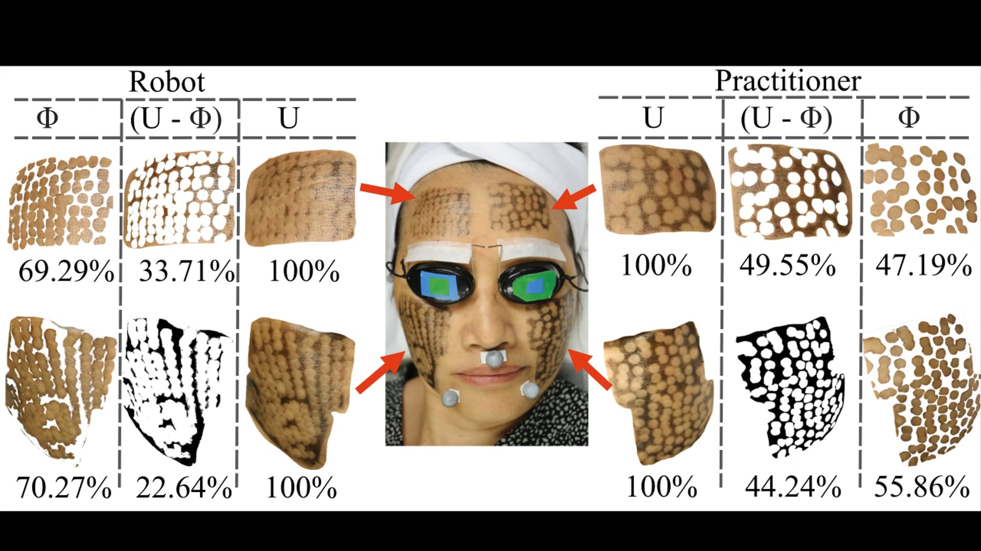 Robotics Meets Cosmetic Dermatology