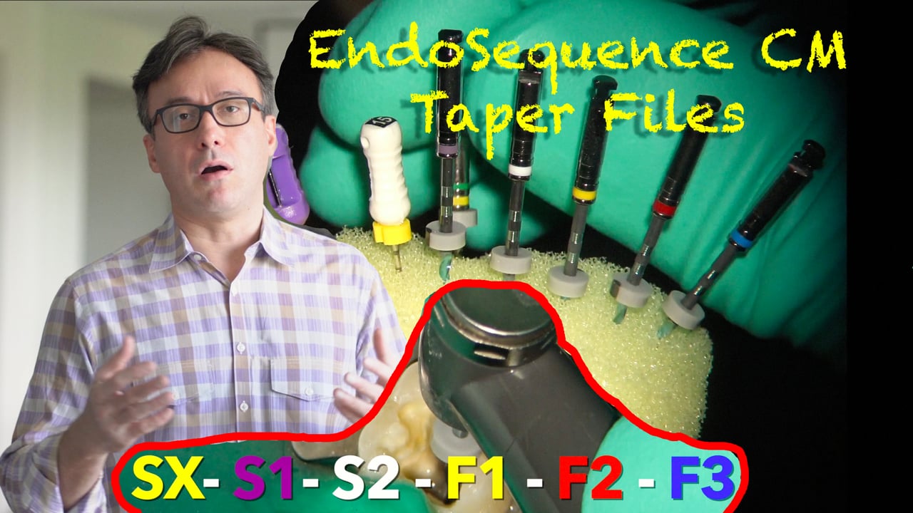 EndoSequence CM Taper & KontrolFlex Accufile Real World Endo