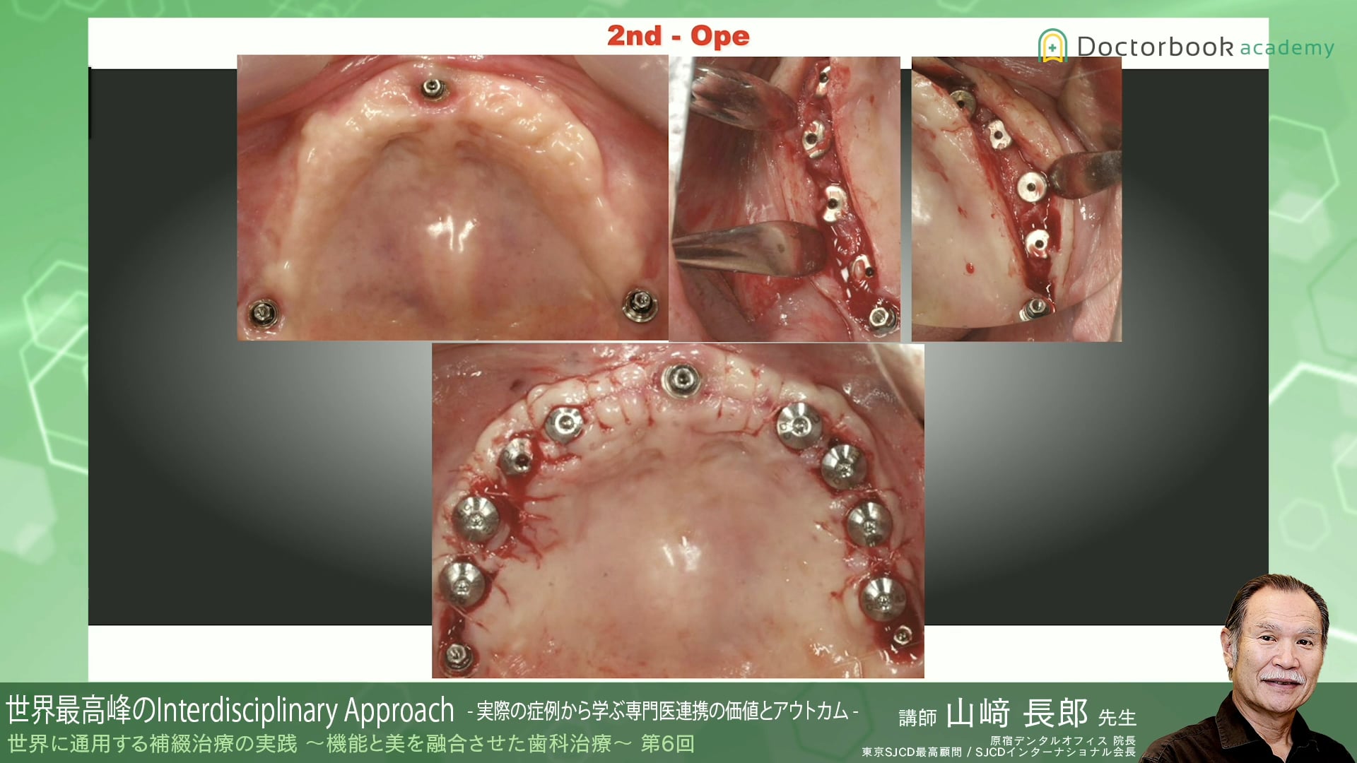 #8 世界最高峰のInterdisciplinary Approach -実際の症例から学ぶ専門医連携の価値とアウトカム-【06/05-06/11 プレミアム化】