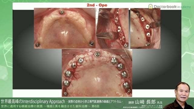 #8 世界最高峰のInterdisciplinary Approach -実際の症例から学ぶ専門医連携の価値とアウトカム-