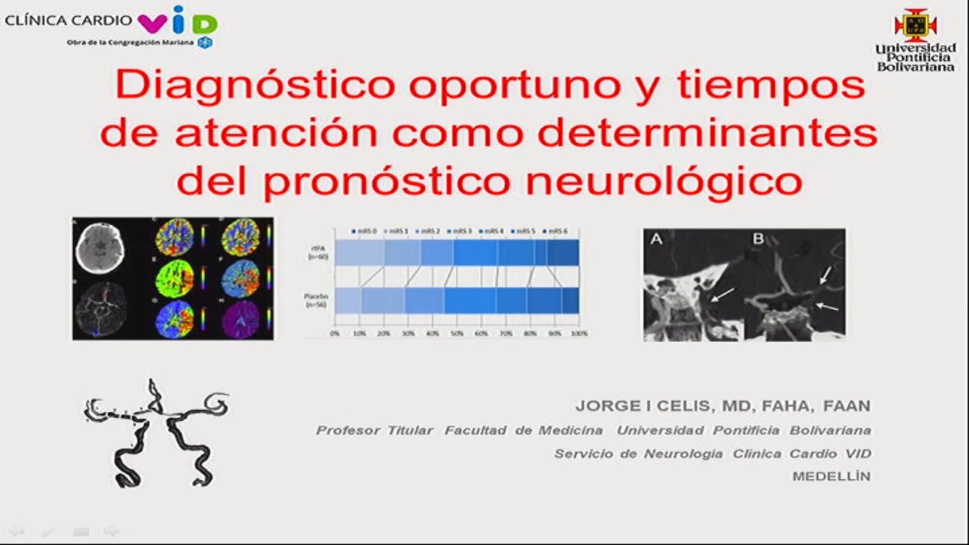 Diagnóstico oportuno y tiempos de intención como determinantes del pronóstico neurológico