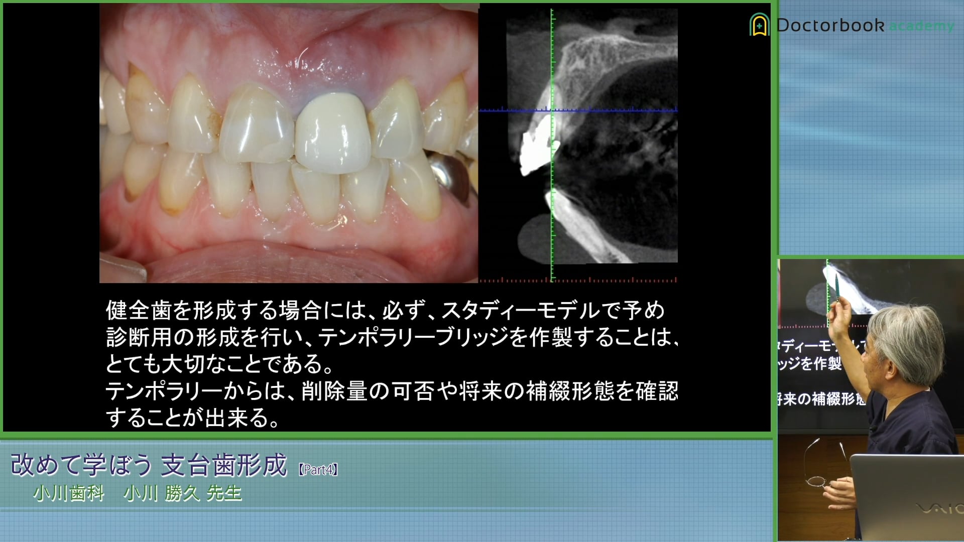 ✨初回限定✨ 20.クラウンブリッジの臨床 : スカンジナビアン