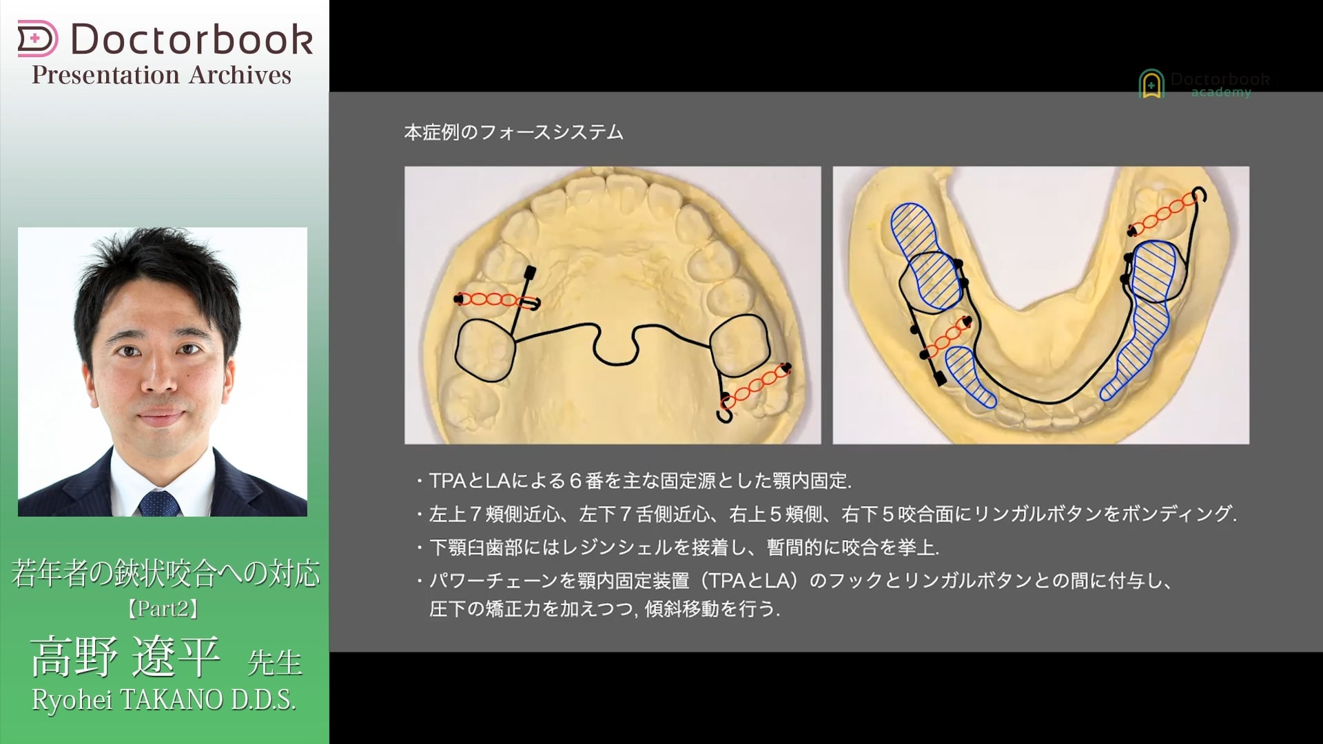 #2 治療計画