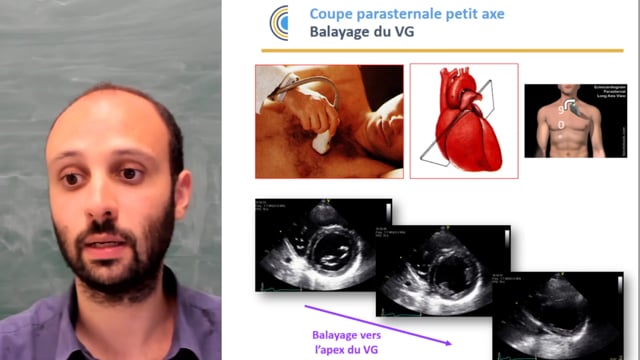 L'essentiel à savoir sur l'échographie cardiaque