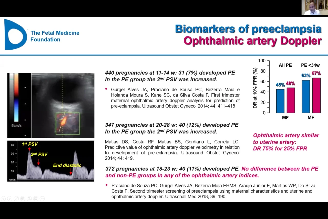 Ophthalmic artery Doppler - Kypros Nicolaides (UK)